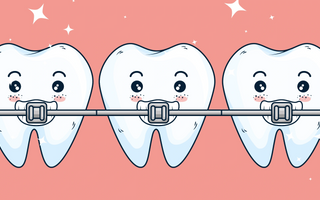 Teeth braces cleaning: How to clean my teeth with braces effectively?