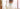 How to find a good dentist for dental implants, dentures, and regular oral checkups